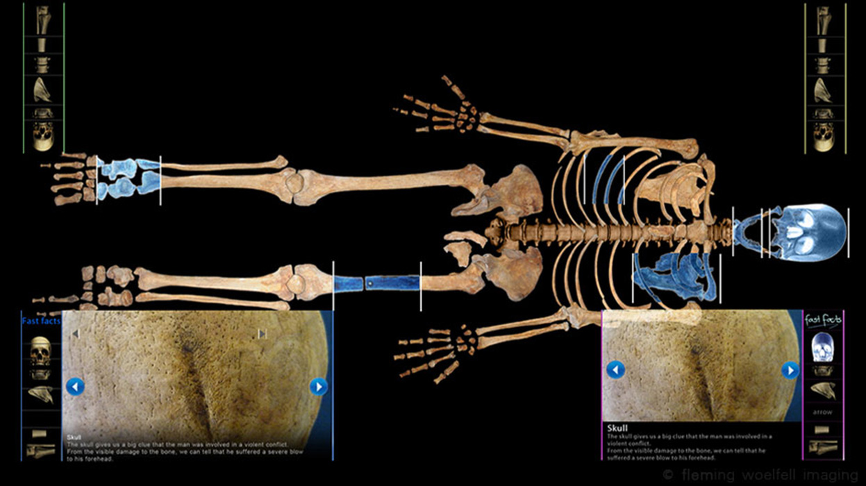 14th C Stirling skeleton multimedia