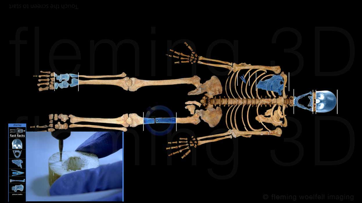 Stirling skeleton bone sampling