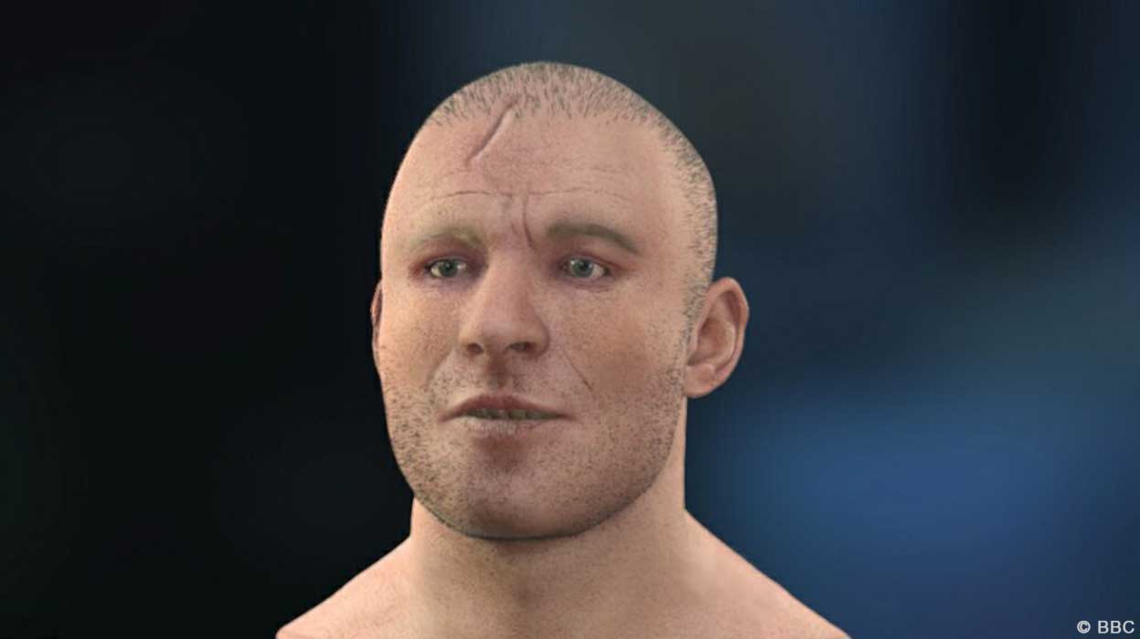 Stirling knight's facial reconstruction